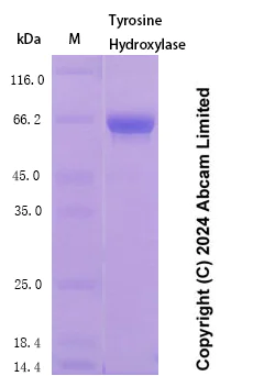 SDS-PAGE - Recombinant Human Tyrosine Hydroxylase Protein Standard (His tag) (AB323068)