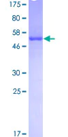 SDS-PAGE - Recombinant Human U1A protein (AB132467)