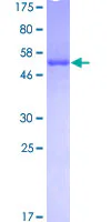 SDS-PAGE - Recombinant Human U1A protein (GST tag N-Terminus) (AB132467)