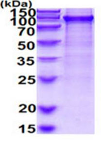 SDS-PAGE - Recombinant Human UBA2 protein (His tag) (AB219280), expandable thumbnail