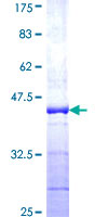 SDS-PAGE - Recombinant Human UBA52 protein (GST tag N-Terminus) (AB159768)