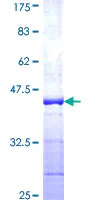 SDS-PAGE - Recombinant Human UBA52 protein (GST tag N-Terminus) (AB159768)