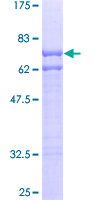 Recombinant Human Uba6 protein