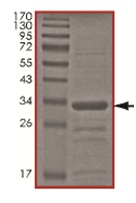 Recombinant Human UBC3B protein