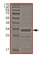 SDS-PAGE - Recombinant Human UBC3B protein (His tag N-Terminus) (AB167962)