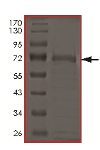 SDS-PAGE - Recombinant Human UBC6e protein (Tagged) (AB177256)