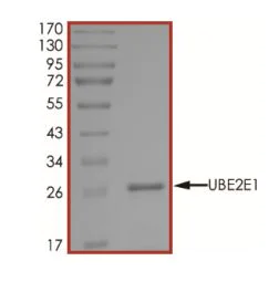 SDS-PAGE - Recombinant human UBCH6/UBE2E1 protein (Active) (His tag N-Terminus) (AB269099)