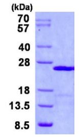SDS-PAGE - Recombinant Human UBCH6/UBE2E1 protein (His tag N-Terminus) (AB131681)