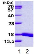 SDS-PAGE - Recombinant Human UBE2D4 protein (AB113402)