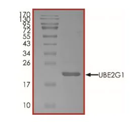 SDS-PAGE - Recombinant human Ube2G1 protein (Active) (AB269101)