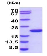 SDS-PAGE - Recombinant Human Ube2G2 protein (His tag N-Terminus) (AB201885)