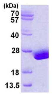SDS-PAGE - Recombinant Human Ube2H protein (AB124593), expandable thumbnail