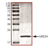 SDS-PAGE - Recombinant Human Ube2H protein (His tag) (AB269102)