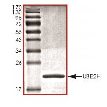 SDS-PAGE - Recombinant Human Ube2H protein (His tag) (AB269102)