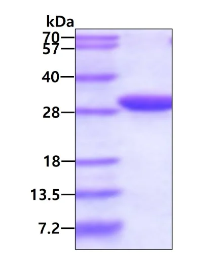 SDS-PAGE - Recombinant Human UBE2J2 protein (His tag N-Terminus) (AB128437)
