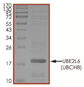 SDS-PAGE - Recombinant human Ube2L6 protein (Active) (AB269106)