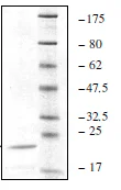 SDS-PAGE - Recombinant human UBE2V1 protein (DDDDK tag N-Terminus) (AB198472)
