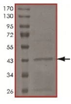 SDS-PAGE - Recombinant Human UBE2W protein (AB167921)