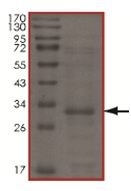 Recombinant Human UBE2Z protein