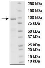 SDS-PAGE - Recombinant human UBE3A protein (AB198417), expandable thumbnail