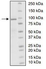 SDS-PAGE - Recombinant human UBE3A protein (AB198417)