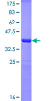 Recombinant Human UBF1 protein