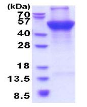 SDS-PAGE - Recombinant Human Ubiquinol-Cytochrome C Reductase Core Protein I (denatured) (His tag N-Terminus) (AB177632)