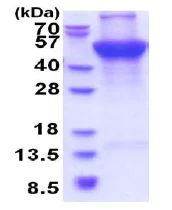 SDS-PAGE - Recombinant Human Ubiquinol-Cytochrome C Reductase Core Protein I (denatured) (His tag N-Terminus) (AB177632)