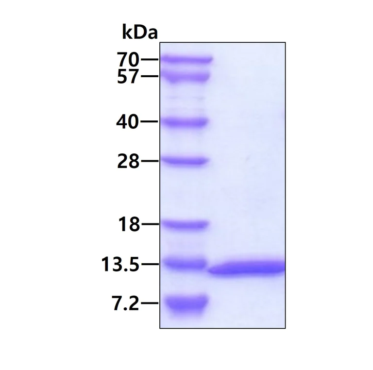 SDS-PAGE - Recombinant Human UBL5 protein (His tag N-Terminus) (AB109343)