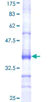 SDS-PAGE - Recombinant Human UBP43/USP18 protein (AB161390)