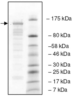SDS-PAGE - Recombinant human UBPY/USP8 protein (AB198666), expandable thumbnail