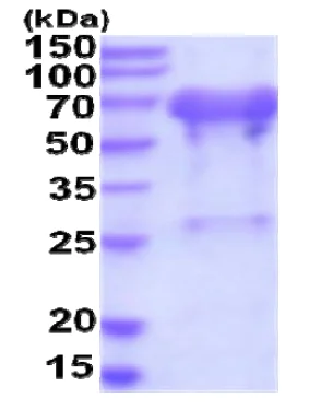 SDS-PAGE - Recombinant Human UBQLN2 protein (His tag N-Terminus) (AB207109)