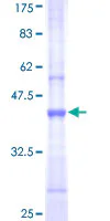 SDS-PAGE - Recombinant Human UBR1 protein (GST tag N-Terminus) (AB165841)