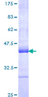 SDS-PAGE - Recombinant Human UBR4/p600 protein (AB153218), expandable thumbnail