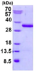 SDS-PAGE - Recombinant Human UBTD2 protein (His tag N-Terminus) (AB131702)