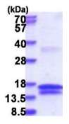 SDS-PAGE - Recombinant Human UCK protein (denatured) (AB181890)