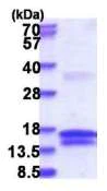 SDS-PAGE - Recombinant Human UCK protein (denatured) (His tag N-Terminus) (AB181890)