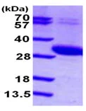 SDS-PAGE - Recombinant Human UCK2 protein (AB102023)