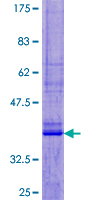 SDS-PAGE - Recombinant Human UCN2/SRP protein (GST tag N-Terminus) (AB164813)