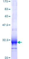SDS-PAGE - Recombinant Human UCP1 protein (AB152782)