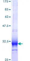 SDS-PAGE - Recombinant Human UCP1 protein (GST tag N-Terminus) (AB152782)