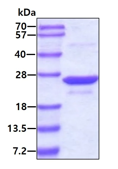 SDS-PAGE - Recombinant Human UFC1 protein (AB107151)
