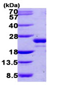 SDS-PAGE - Recombinant Human UFC1 protein (AB107151), expandable thumbnail