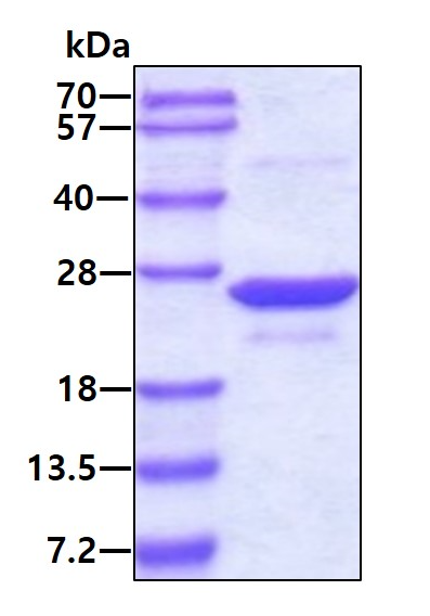 SDS-PAGE - Recombinant Human UFC1 protein (His tag N-Terminus) (AB107151)