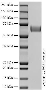 SDS-PAGE - Recombinant Human UFO (AXL) Protein (AB290055)