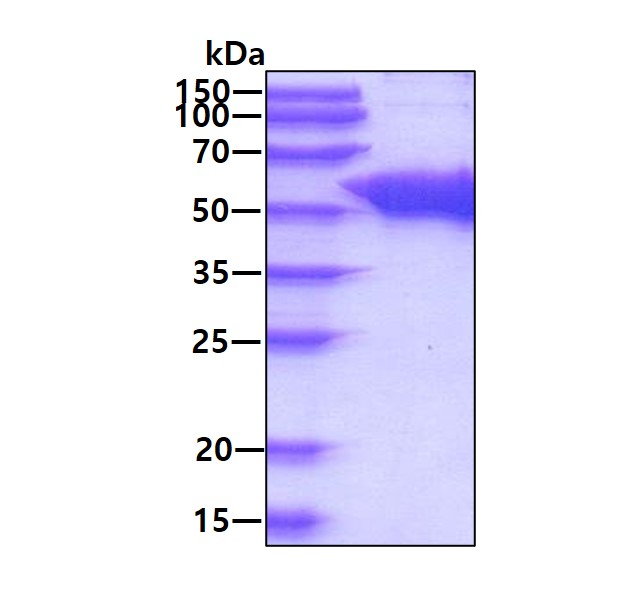 SDS-PAGE - Recombinant Human UGPase protein (AB187440)