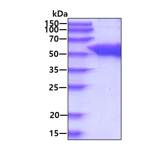 SDS-PAGE - Recombinant Human UGPase protein (AB187440)