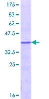 Recombinant Human UGT1A1 protein