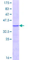 SDS-PAGE - Recombinant Human UGT1A1 protein (AB162807)