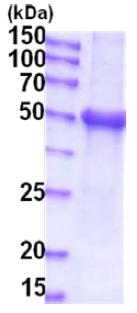 SDS-PAGE - Recombinant Human UGT1A1 protein (denatured) (His tag N-Terminus) (AB202607)